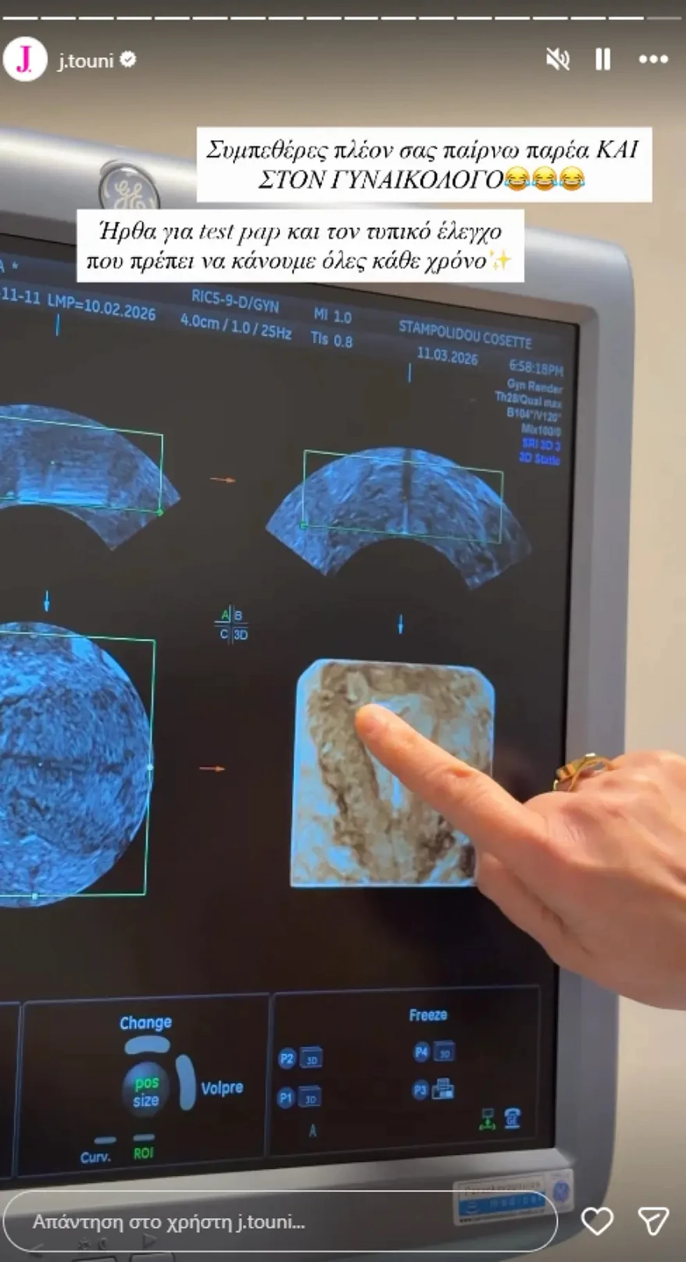 Ιωάννα Τούνη: Η αντίδρασή της στις φήμες για δεύτερο παιδί ΦΩΤΟ