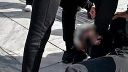 Μόνιμη βλάβη στο μάτι για 16χρονο που ξυλοκοπήθηκε από ανήλικους στα Ιωάννινα