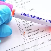 Κλιμάκιο του ΕΟΔΥ στη Ζάκυνθο για τα κρούσματα λεπτοσπείρωσης το ένα θανατηφόρο