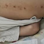 Πάτρα: Στην φυλακή η μητέρα και ο σύντροφος του κακοποιημένου παιδιού στο «Καραμανδάνειο» νοσοκομείο