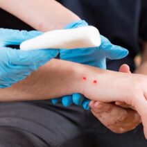 Σύρος: Σε σοβαρή κατάσταση παιδί από δάγκωμα οχιάς 17 Σύρος: Σε σοβαρή κατάσταση παιδί από δάγκωμα οχιάς