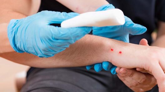 Σύρος: Σε σοβαρή κατάσταση παιδί από δάγκωμα οχιάς