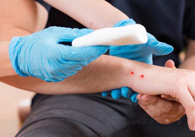 Σύρος: Σε σοβαρή κατάσταση παιδί από δάγκωμα οχιάς 24 Σύρος: Σε σοβαρή κατάσταση παιδί από δάγκωμα οχιάς