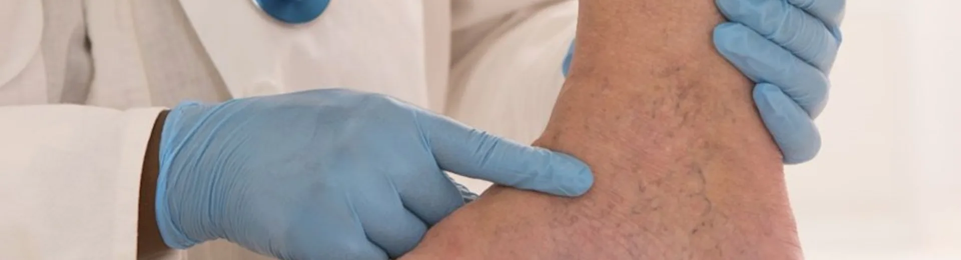 Θρόμβωση: 7 «σιωπηλά» σημάδια που δεν πρέπει να αγνοήσετε