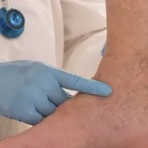 Θρόμβωση: 7 «σιωπηλά» σημάδια που δεν πρέπει να αγνοήσετε