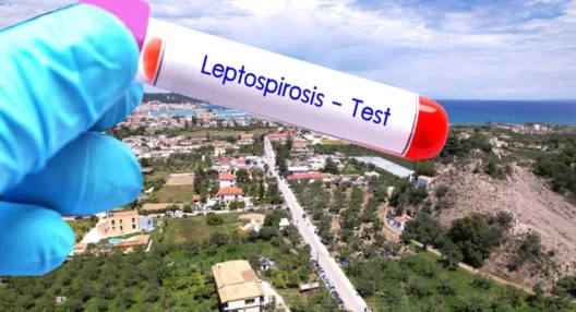 Ζάκυνθος: Εκτακτη σύσκεψη μετά τα κρούσματα λεπτοσπείρωσης, το ένα θανατηφόρο