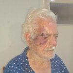 Πάτρα: Σοκάρουν τα σημάδια σε 90χρονο σε απόπειρα ληστείας- Καθηλωμένη η συζύγός του