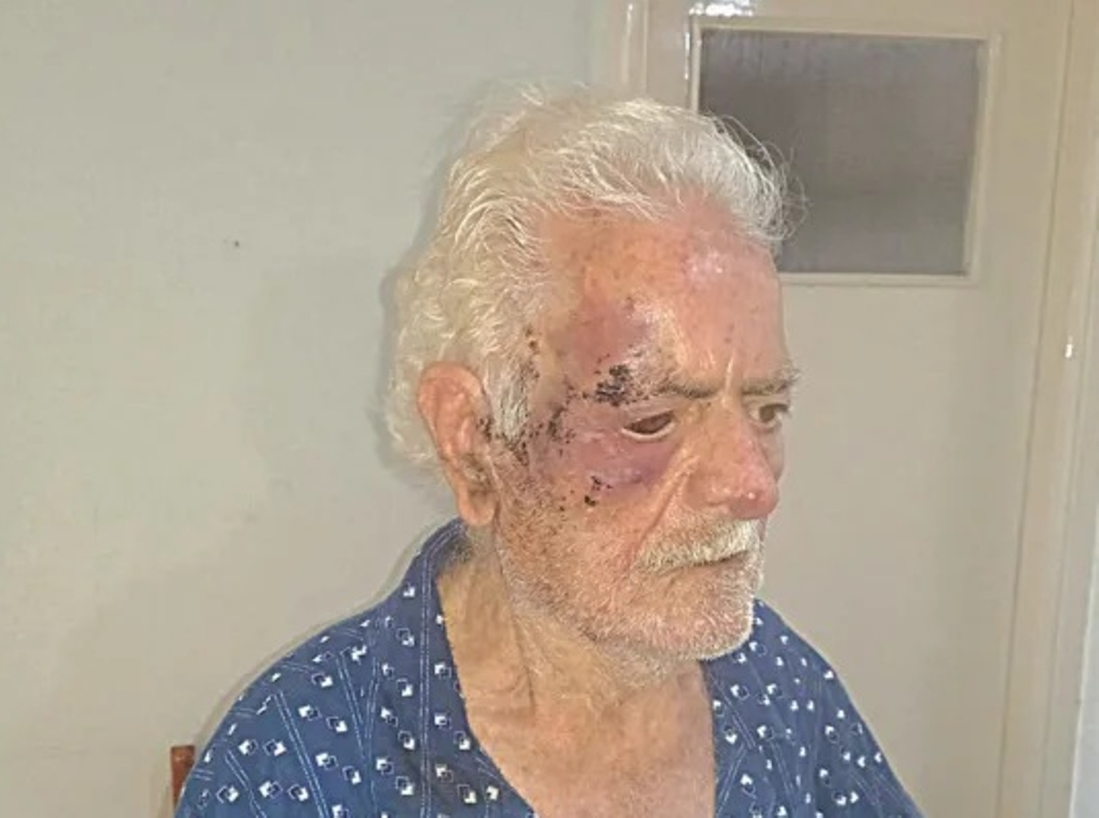 Πάτρα: Αυτός είναι ο δράστης που «βασάνισε» ηλικιωμένο ζευγάρι