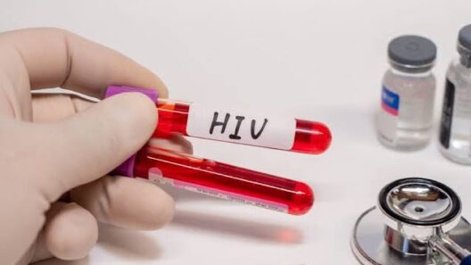 Σαντορίνη: Γιατρός εκτέθηκε στον ιό HIV και ενημέρωσε 38 ώρες μετά 15 Σαντορίνη για την ημέρα κατά του HIV