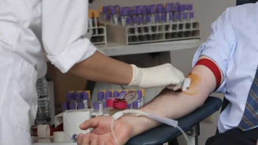 Πάτρα: Επείγουσα ανάγκη για αίμα σε ασθενή του νοσοκομείου Ρίου 17 Πάτρα: Επείγουσα ανάγκη για αίμα σε ασθενή του νοσοκομείου Ρίου