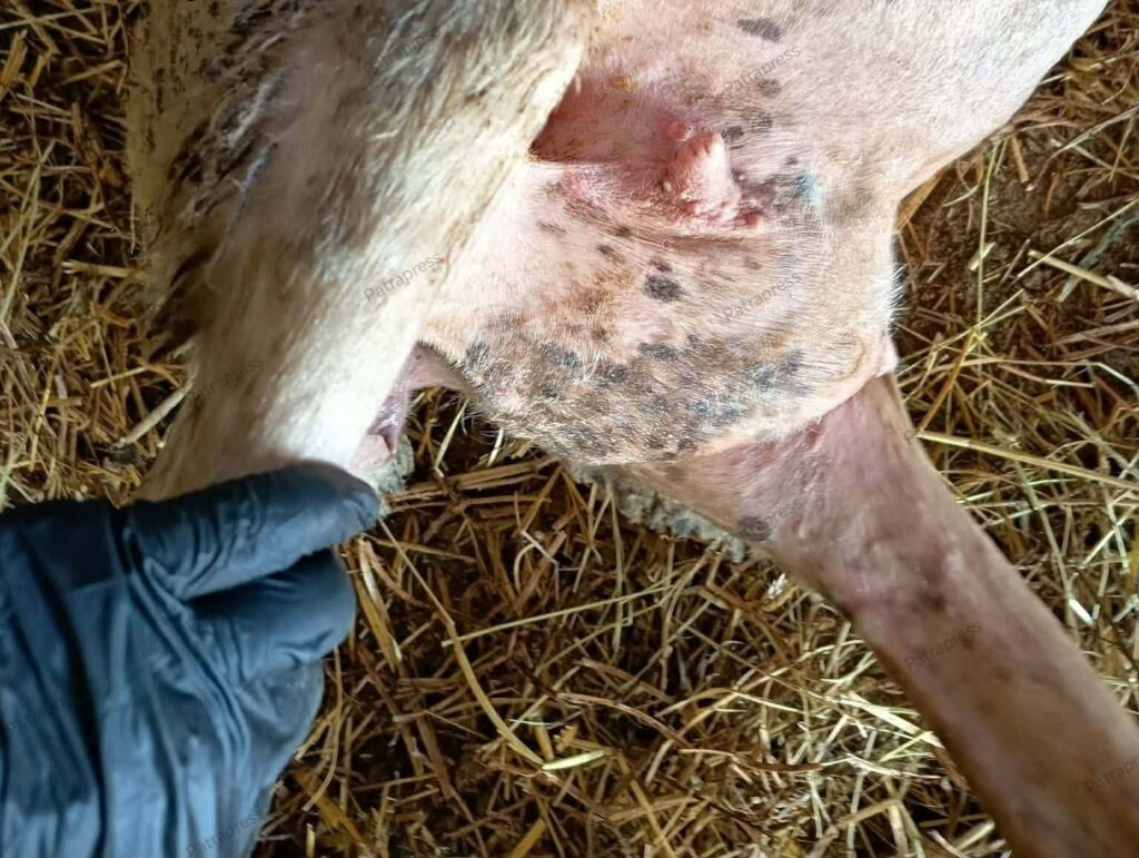 Αποκλειστικό: Νέο κρούσμα ευλογιάς