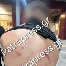 Ρίο: Ντοκουμέντα από την άγρια επίθεση με κατσαβίδι σε 18χρονο έξω από νυχτερινό κατάστημα – Στο «μικροσκόπιο» της ΕΛ.ΑΣ πατέρας και γιος ΑΠΟΚΛΕΙΣΤΙΚΕΣ ΦΩΤΟ 3 Ρίο: Ντοκουμέντα από την άγρια επίθεση με κατσαβίδι σε 18χρονο έξω από νυχτερινό κατάστημα – Στο «μικροσκόπιο» της ΕΛ.ΑΣ πατέρας και γιος ΑΠΟΚΛΕΙΣΤΙΚΕΣ ΦΩΤΟ