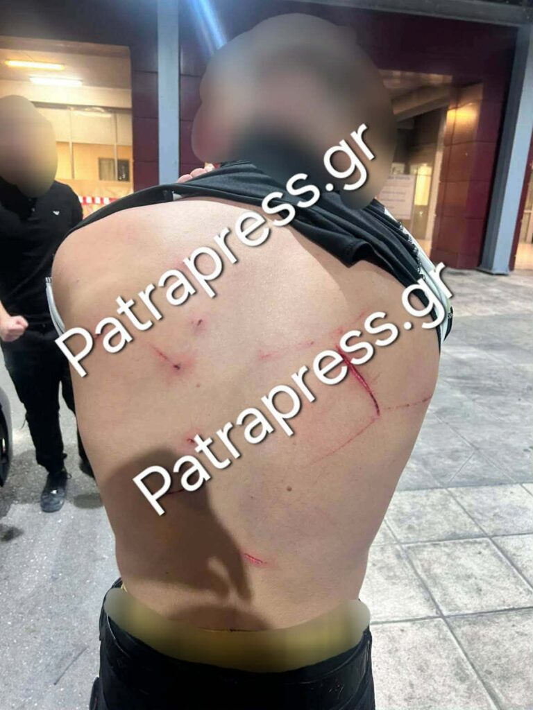 Ρίο: Ντοκουμέντα από την άγρια επίθεση με κατσαβίδι σε 18χρονο έξω από νυχτερινό κατάστημα – Στο «μικροσκόπιο» της ΕΛ.ΑΣ πατέρας και γιος ΑΠΟΚΛΕΙΣΤΙΚΕΣ ΦΩΤΟ 5 Ρίο: Ντοκουμέντα από την άγρια επίθεση με κατσαβίδι σε 18χρονο έξω από νυχτερινό κατάστημα – Στο «μικροσκόπιο» της ΕΛ.ΑΣ πατέρας και γιος ΑΠΟΚΛΕΙΣΤΙΚΕΣ ΦΩΤΟ