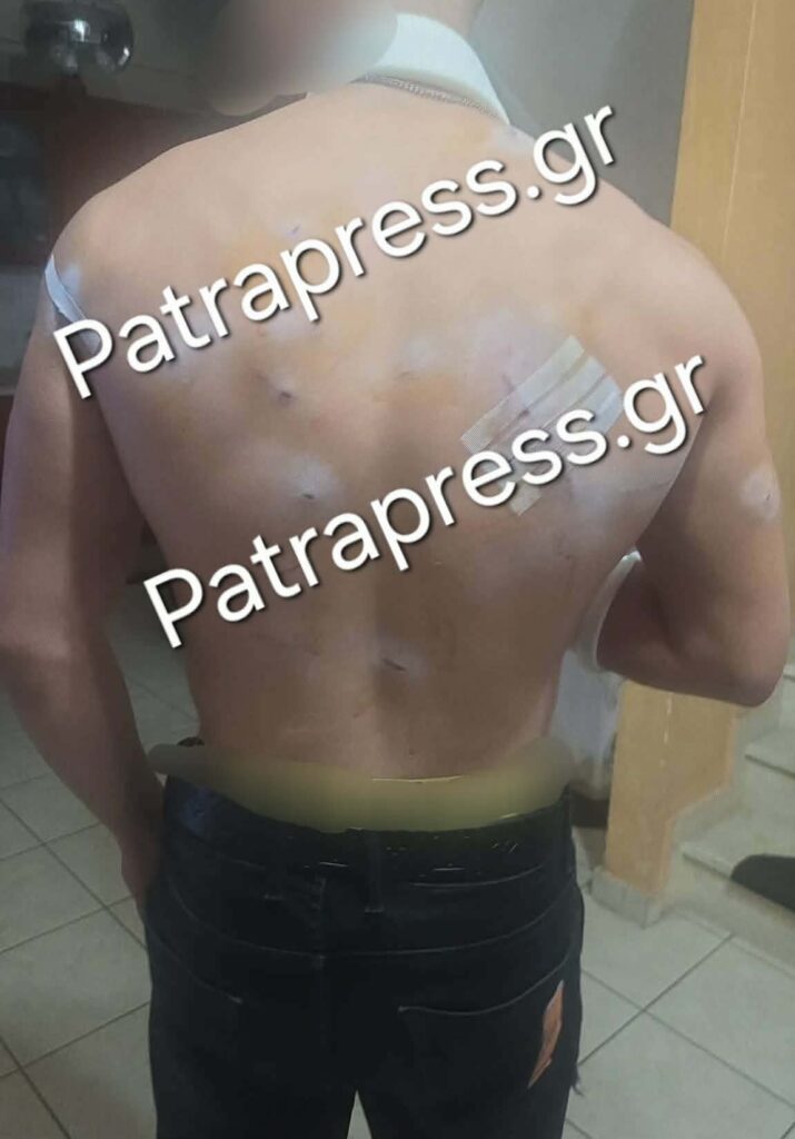Ρίο: Ντοκουμέντα από την άγρια επίθεση με κατσαβίδι σε 18χρονο έξω από νυχτερινό κατάστημα – Στο «μικροσκόπιο» της ΕΛ.ΑΣ πατέρας και γιος ΑΠΟΚΛΕΙΣΤΙΚΕΣ ΦΩΤΟ 6 Ρίο: Ντοκουμέντα από την άγρια επίθεση με κατσαβίδι σε 18χρονο έξω από νυχτερινό κατάστημα – Στο «μικροσκόπιο» της ΕΛ.ΑΣ πατέρας και γιος ΑΠΟΚΛΕΙΣΤΙΚΕΣ ΦΩΤΟ