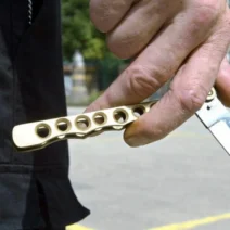 Αίγιο: Επίθεση με μαχαίρι σε ανήλικους και απόπειρα παράσυρσης με αυτοκίνητο